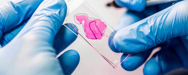 An introductory guide to biomarkers, precision, personalised and stratified medicine.