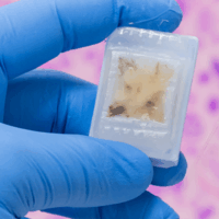 Unlocking High-Quality NGS Data from Challenging Clinical Samples